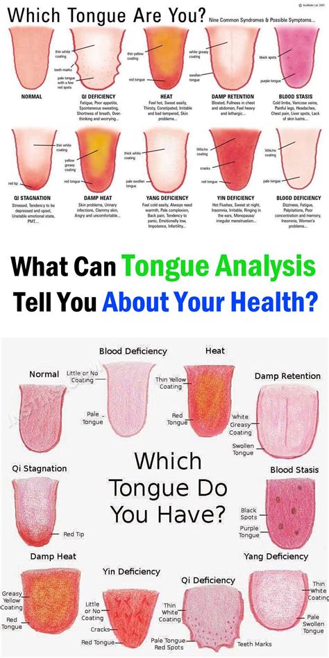 What Your Tongue Says About Your Health